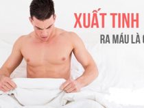 Xuất tinh ra máu khám ở đâu tốt tại Hà Nội – Phòng Khám Hưng Thịnh