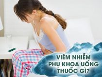 Viêm nhiễm phụ khoa uống thuốc gì [Top 20 loại thuốc tốt]