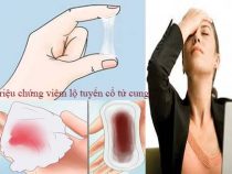 [ Cảnh báo ] 5 Dấu hiệu viêm cổ tử cung Nặng và Nhẹ ở phụ nữ