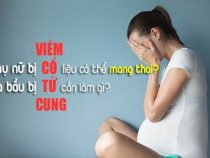 5 Điều cần thiết phải lưu ý