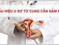 U xơ tử cung Nguyên nhân , triệu chứng và cách điều trị