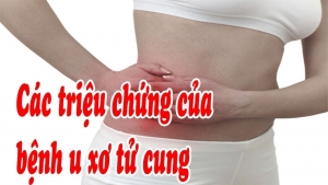 dấu hiệu u xơ tử cung