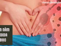triệu chứng và cách điều trị tốt nhất