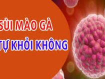 [ Sùi mào gà có tự khỏi được không ? ] Có tự hết được không ?