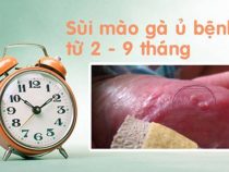 [ Giải đáp ] Thời gian ủ căn bệnh sùi mào gà là bao lâu thì phát tác