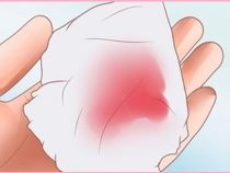 Ra khí hư màu hồng nhạt là bênh gì ? Nguyên nhân vì đâu