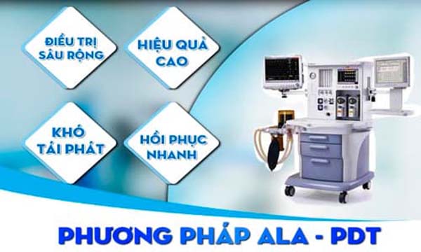 Chữa sùi mào gà bằng hương pháp ala-pdt