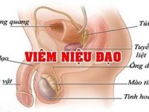 [ GIẢI ĐÁP ] Viêm niệu đạo có mắc phải vô sinh không ? 5 cách trị an toàn và tốt nhất