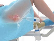 Quy trình thực hiện và những lời khuyến khích trước khi tiến hành