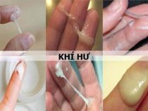[ Tổng hợp ] 5+ cách nhận biết chứng bệnh phụ khoa qua khí hư dễ thực hiện