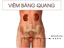[ Review ] 10+ thuốc đông y trị viêm bọng đái tốt nhất và an toàn
