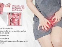 Nấm Candida đường sinh dục là sao ? Nguyên nhân, triệu chứng và cách điều trị