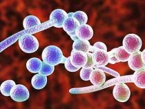 [ Giải Đáp ] Nâm Candida sống được bao lâu và điều trị thế nào hữu hiệu