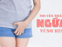 [ Chi tiết ] Hình ảnh ngứa ngáy vùng kín theo từng thời kỳ và cách chữa trị