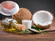 [ Review ] 5+ cách tẩy nấm Candida bằng dầu dừa tốt nhất nhanh