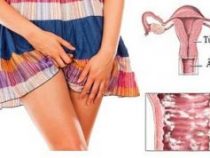 chứng bệnh phụ khoa là sao? Top 5 chứng bệnh phụ khoa thường gặp – Phòng thăm khám Hưng Thịnh