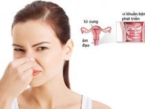 Khí hư ra nhiều có mùi hôi tanh là gặp phải tiến hành sao? – Phòng xét nghiệm Hưng Thịnh