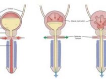 Những dấu hiệu nào cho xuất hiện bạn mắc viêm bọng đái – Phòng kiểm tra Hưng Thịnh