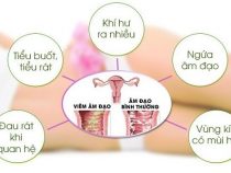 [ Cảnh giác ] 9 dấu hiệu của viêm phụ khoa dễ nhận biết nhất !