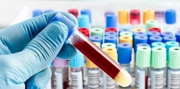 Mẹ bầu nên làm xét nghiệm Double Test vào 11 tuần 1 ngày đến 13 tuần 6 ngày