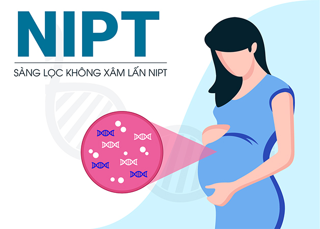 Mẹ bầu nên thực hiện xét nghiệm sàng lọc trước sinh NIPT theo chỉ định của bác sĩ