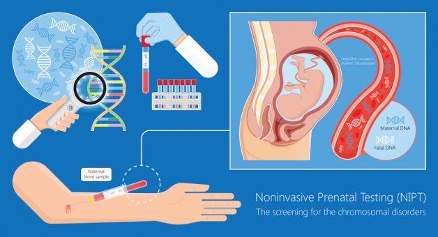 NIPT là xét nghiệm sàn lọc trước sinh không xâm lấn quan trọng giúp phát hiện một số dị tật bẩm sinh ở thai nhi