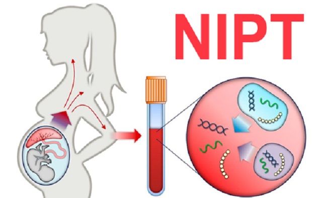 xét nghiệm nipt