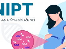 Xét nghiệm sàng lọc trước sinh NIPT phát hiện những hội chứng nào?