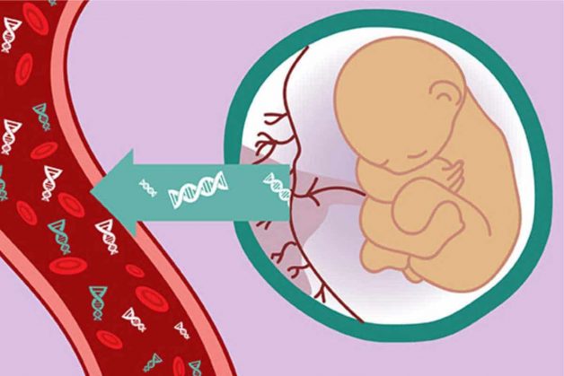 Xét nghiệm sàng lọc trước sinh không xâm lấn NIPT giúp phát hiện sớm những bất thường ở thai nhi