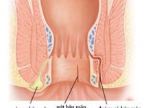 chứng bệnh lỗ rò hậu môn nguy hiểm như thế nào? – Phòng xét nghiệm Hưng Thịnh
