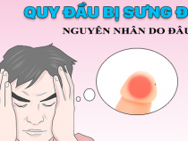 Bao quy đầu mẩn đỏ và ngứa ngáy có nguy hiểm không? – Phòng kiểm tra Hưng Thịnh