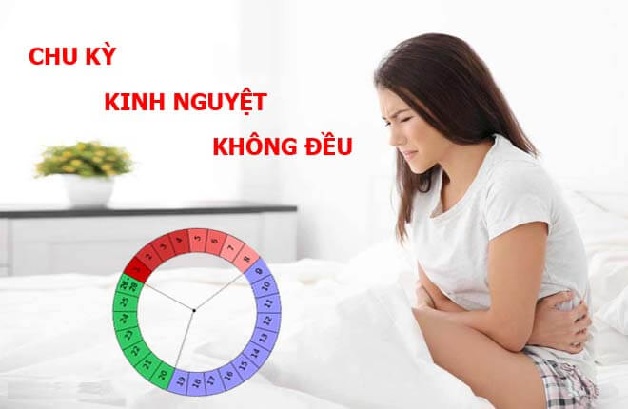 Chu kỳ kinh nguyệt không đều là tình trạng nhiều chị em gặp phải