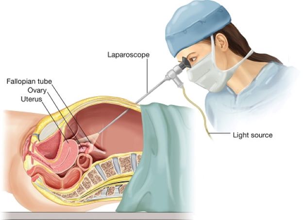 Tùy vào mức độ phát triển của bào thai, bác sĩ sẽ chỉ định phương pháp điều trị phù hợp.