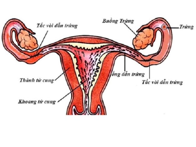 Nhận biết được dấu hiệu tắc ống dẫn trứng sẽ giúp các chị em phụ nữ có biện pháp xử lý kịp thời.