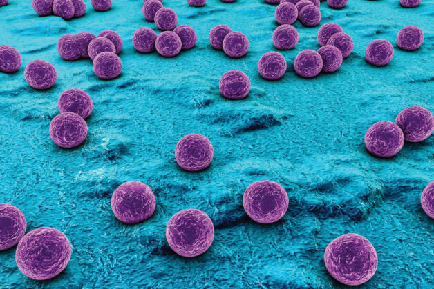 Staphylococcus aureus là một trong hai bệnh lý gây nên bệnh lý áp xe vú