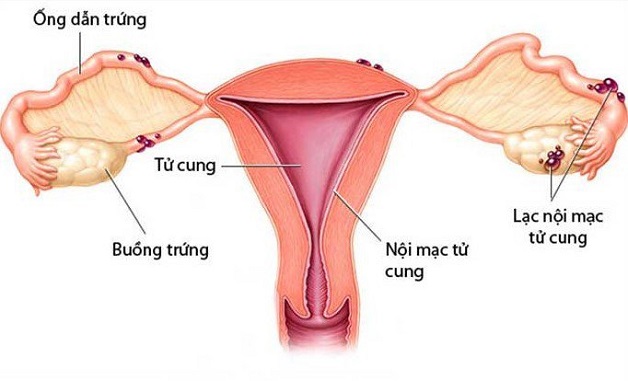 Nội mạc nằm bên trong tử cung, phát triển nhờ vào hormon estrogen có trong cơ thể nữ giới