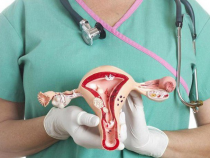 Polyp cổ tử cung khi mang thai: những điều mẹ bầu nên biết