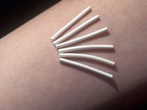 Cấy que tránh thai và những điều chị em nên biết