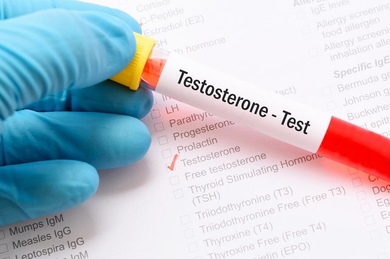 Xét nghiệm testosterone nhằm xác định nồng độ testosterone toàn phần ở trong máu