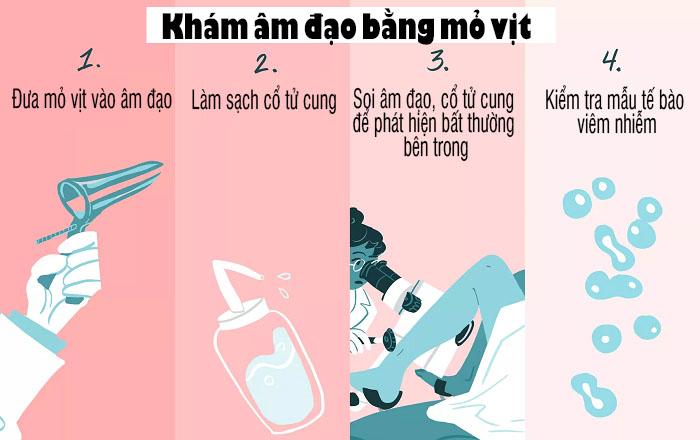 Mỏ vịt là dụng cụ chuyên khoa, giúp bác sĩ quan sát đầy đủ và chi tiết những bộ phận bên trong.