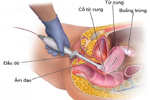 siêu âm đầu dò nhiều có hại không 