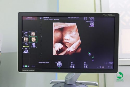Hình ảnh siêu âm 5D