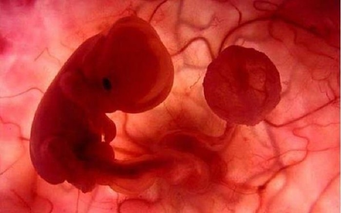 Túi ối là một túi chất lỏng nằm trong dạ con giúp bao bọc, nuôi dưỡng thai nhi từ khi hình thành cho đến lúc chào đời.