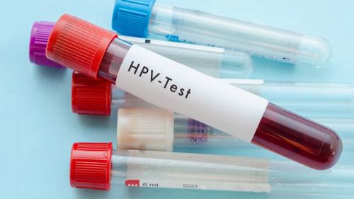 Virus HPV lây truyền chủ yếu qua đường tình dục, vì vậy những người có nhiều bạn tình sẽ có nguy cơ lây nhiễm virus này cao hơn