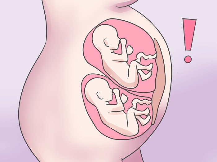 Những mẹ mang đa thai cũng có nguy cơ mắc tiền sản giật.
