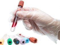 xét nghiệm Double test-Quy trình, Kết quả -âm tính-dương tính