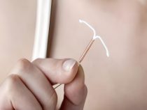 18 tuổi có đặt vòng tránh thai được không?