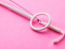 Đặt vòng tránh thai IUD và những thông tin nên biết
