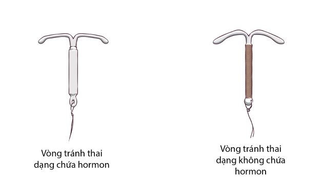 Cả 2 loại vòng tránh thai đều có tác dụng cản trở quá trình trứng và tinh trùng gặp nhau