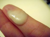 Dấu hiệu nhận biết căn bệnh phụ khoa ở nữ giới